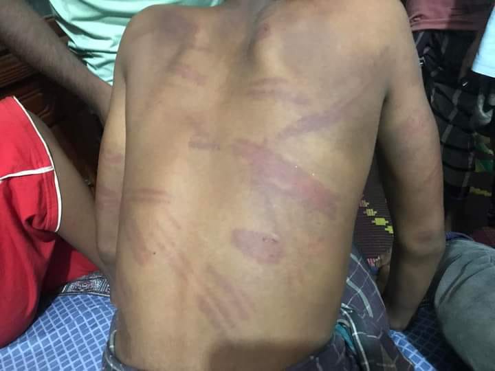ঝিনাইদহে ভাত চুরির অপবাদে মাদ্রাসা ছাত্রকে হাত-পা বেঁধে অমানবিক নির্যাতন