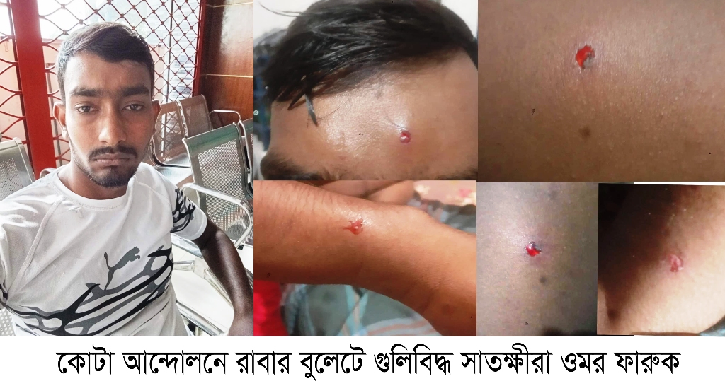 বৈষম্য বিরোধী আন্দোলনে গুলিবিদ্ধ ওমরকে বাঁচাতে সহযোগীতার আহবান